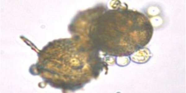 Article teaser image