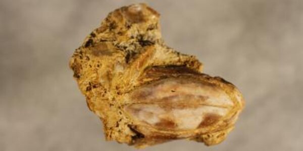 Article teaser image