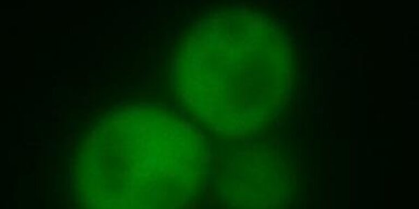 Article teaser image