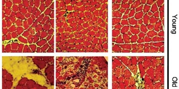 Article teaser image