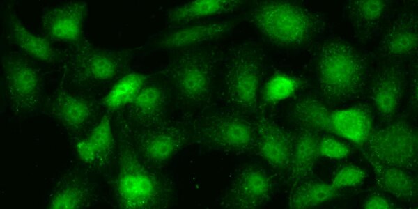 Article teaser image