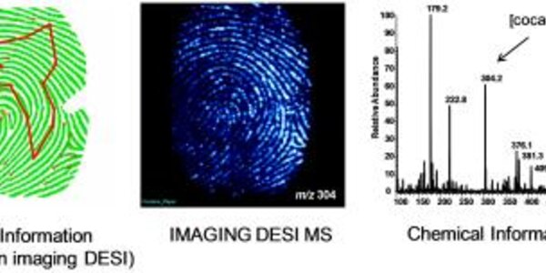 Article teaser image