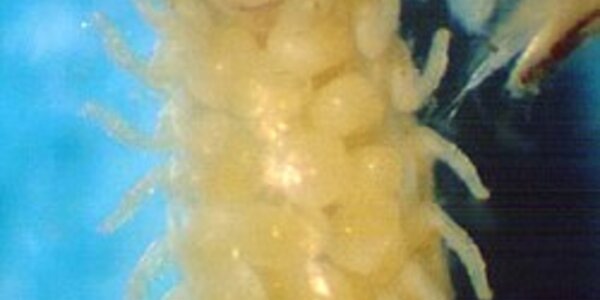 Article teaser image