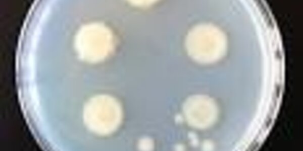 Article teaser image