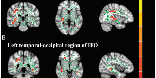 Article teaser image