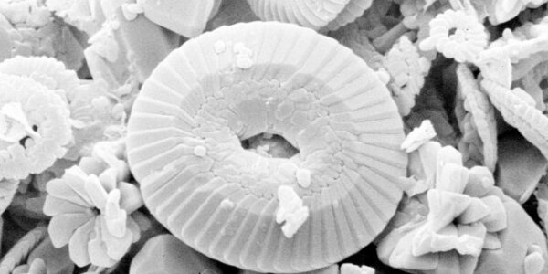 Article teaser image