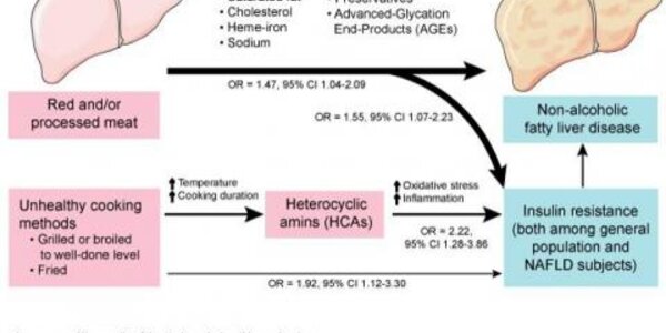Article teaser image