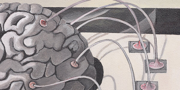 Article teaser image