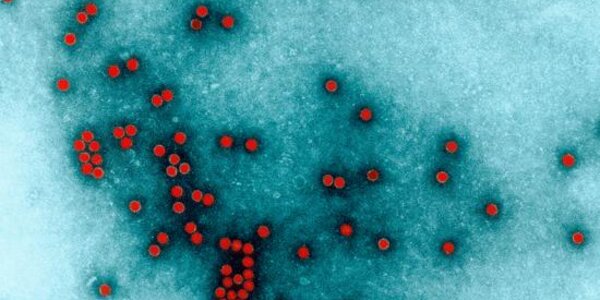 Article teaser image