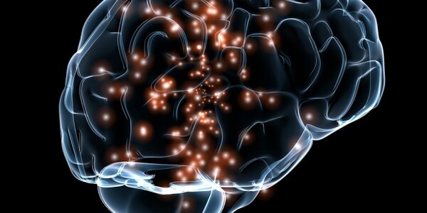 Article teaser image