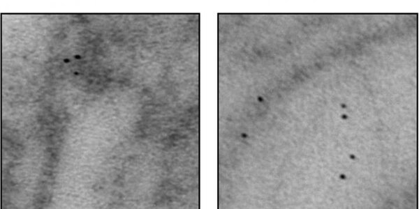 Article teaser image