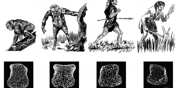 Article teaser image