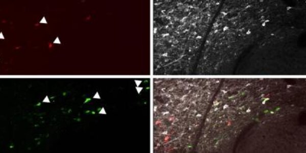 Article teaser image