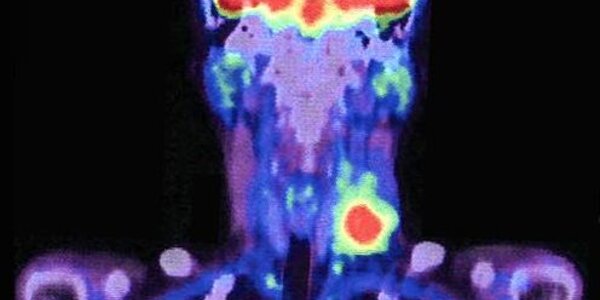 Article teaser image