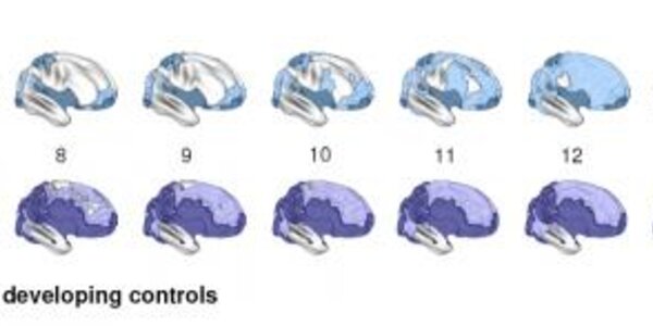 Article teaser image