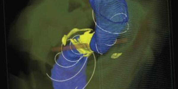 Article teaser image