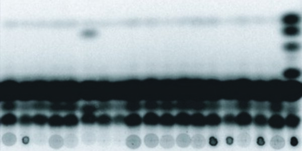 Article teaser image