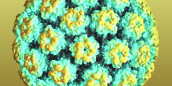 Article teaser image