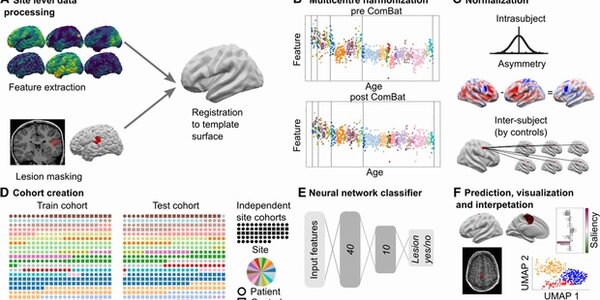 Article teaser image