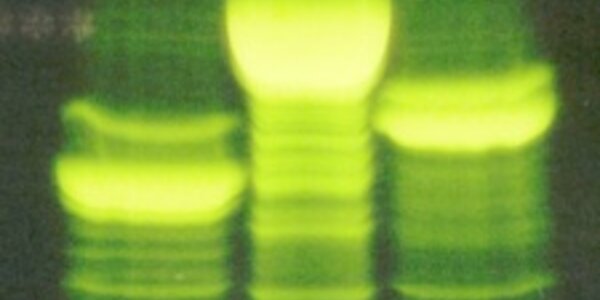 Article teaser image