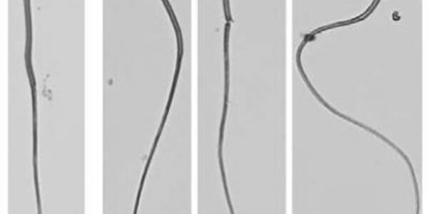 Article teaser image