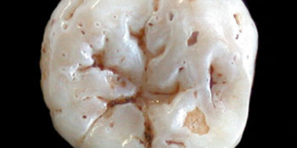 Article teaser image