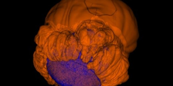 Article teaser image