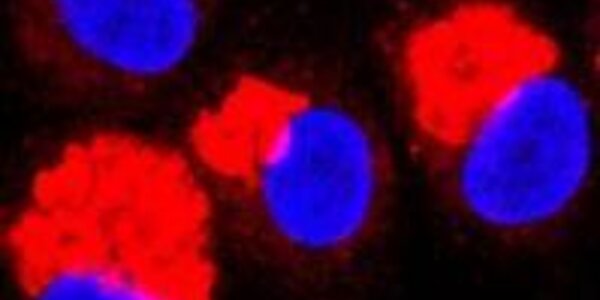 Article teaser image