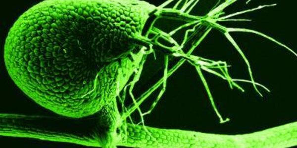 Article teaser image