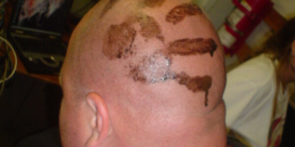 Article teaser image