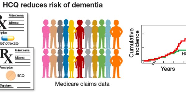 Article teaser image