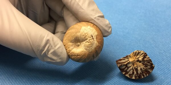 Article teaser image