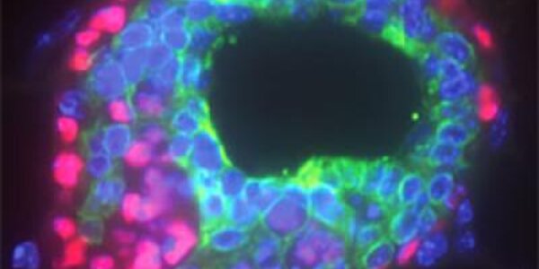 Article teaser image