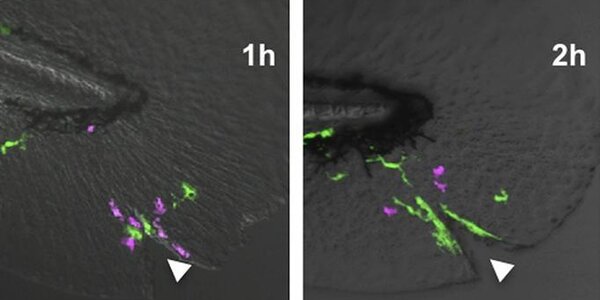 Article teaser image