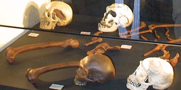 Article teaser image