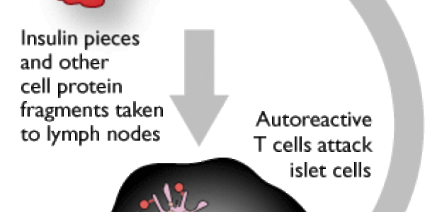 Article teaser image