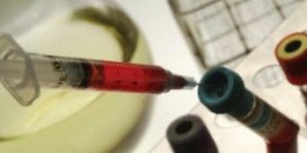 Article teaser image