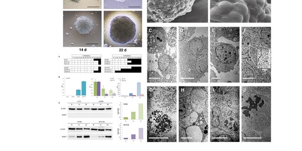 Article teaser image