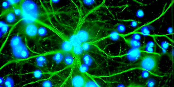 Article teaser image