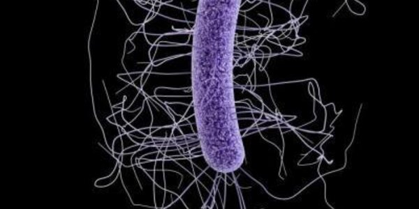 Article teaser image