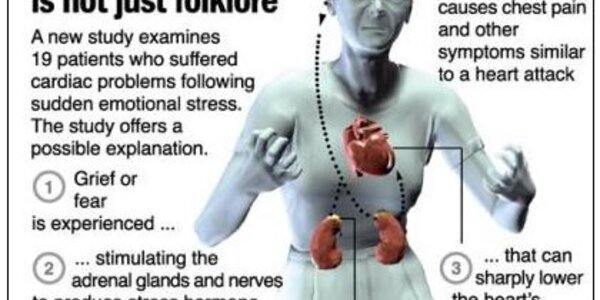 Article teaser image