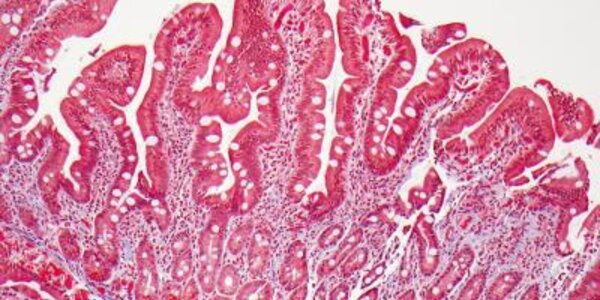 Article teaser image