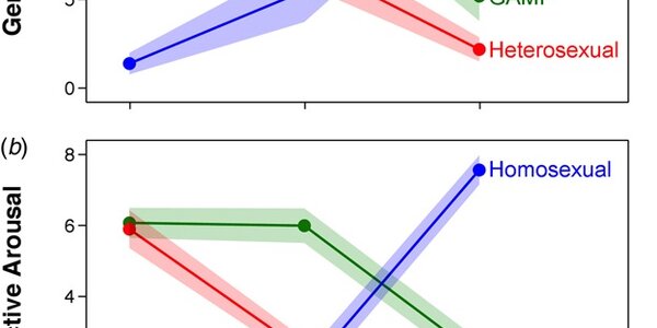 Article teaser image