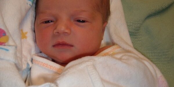 Article teaser image