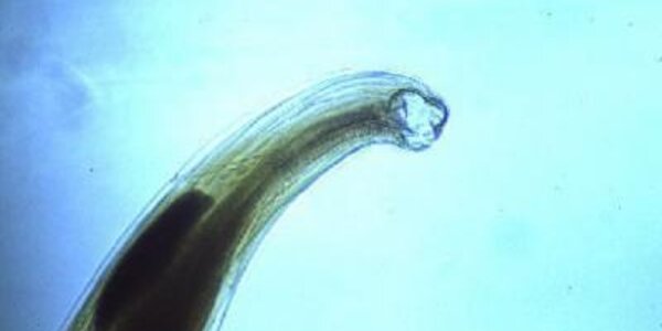 Article teaser image