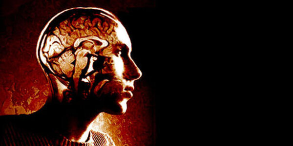 Article teaser image