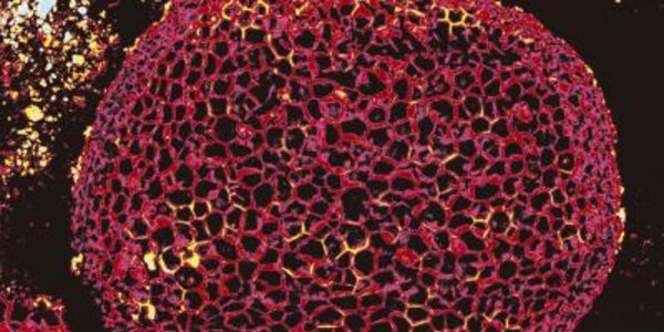 Article teaser image