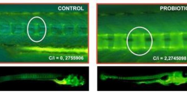 Article teaser image