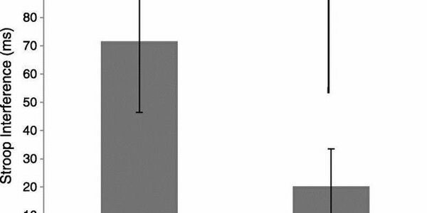 Article teaser image