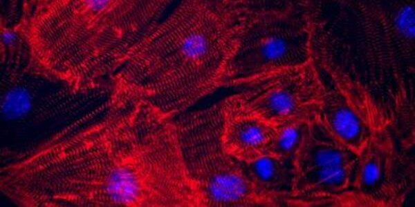 Article teaser image